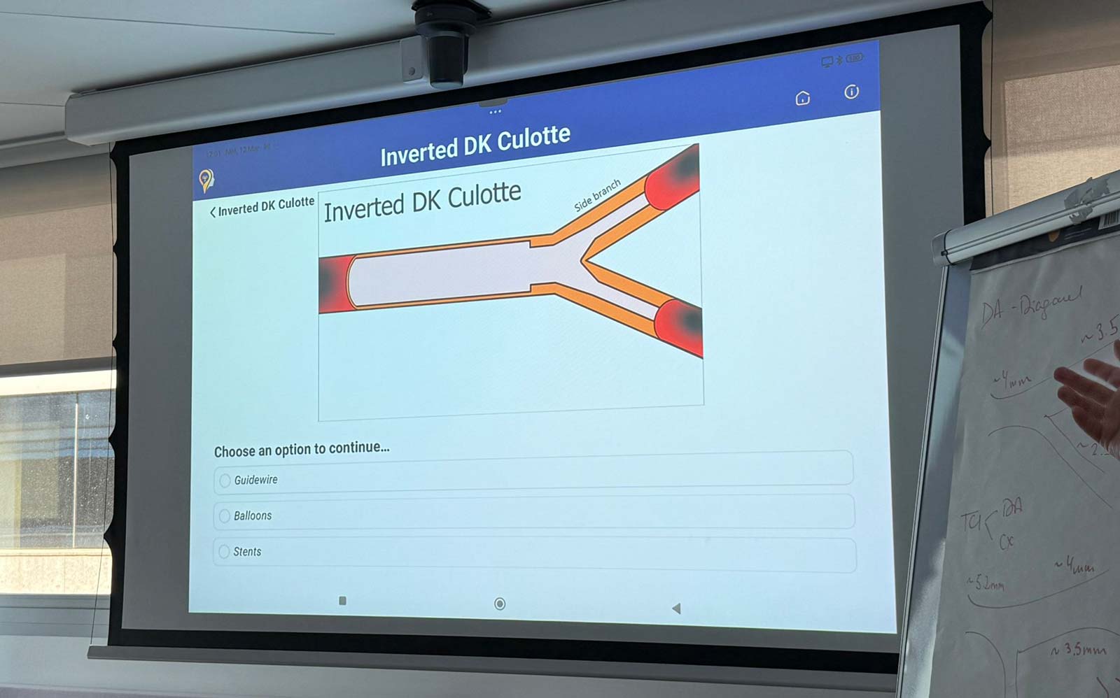 Mindsite,-CHIP-Boston-Madrid,-simulation-training-for-highly-complex-coronary-procedures-2